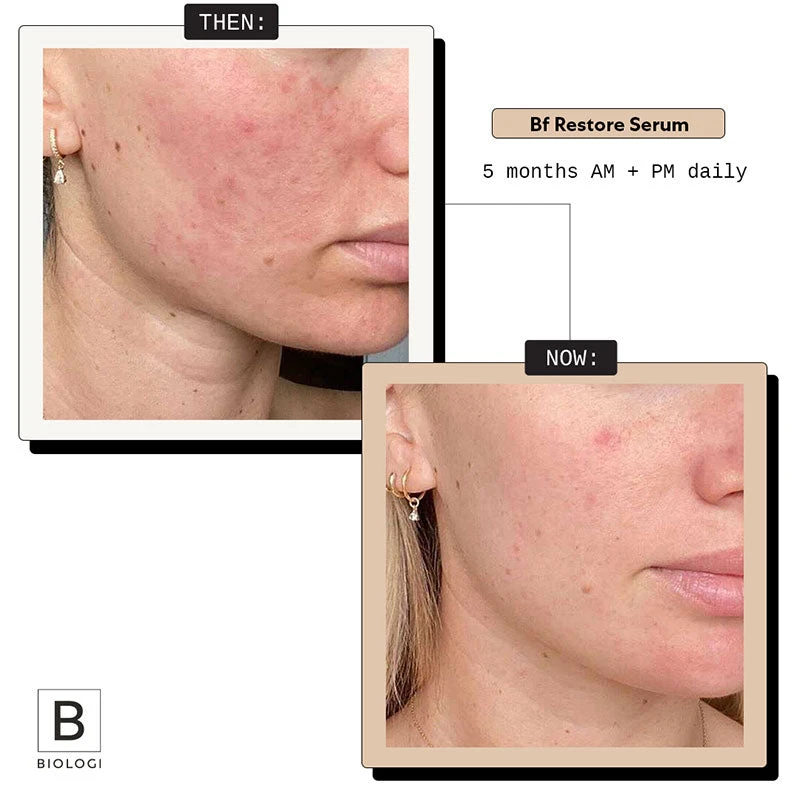 Biologi Bf Restore Face & Body Serum 20ml 3 Biologi Bf Restore Face & Body Serum 20ml - Image 3