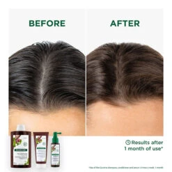 Klorane Strengthening Quinine & Organic Edelweiss Shampoo 400ml -Cheap Wellness Beauty Store Klorane Sham Quinine400ml 3