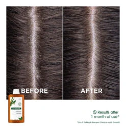 Klorane Anti-dandruff Rebalancing Shampoo With Galangal & AHA 400ml -Cheap Wellness Beauty Store P0002244 4